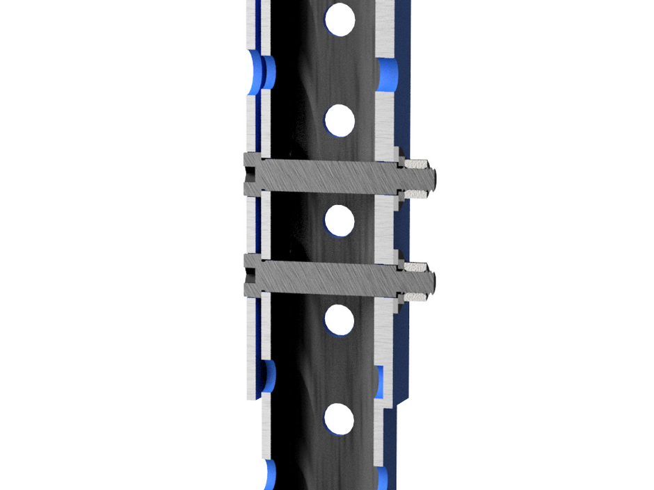 Adjustable Legs